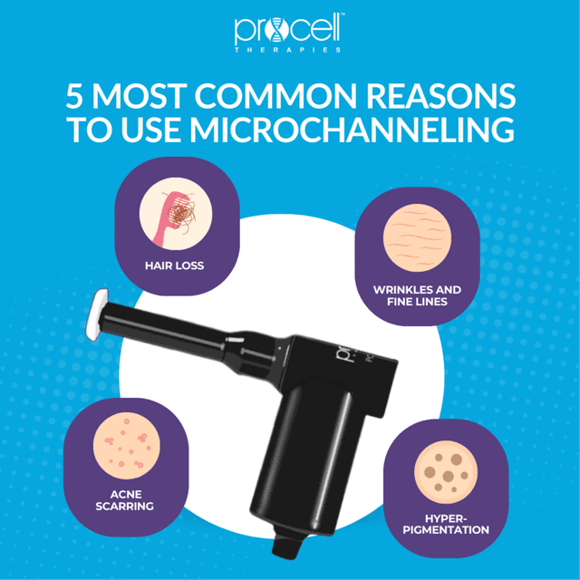 Ultimate Microchannel Glow - PRO  